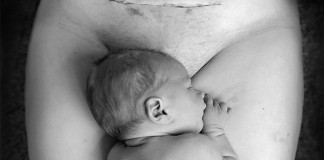 Silná popôrodná fotka bábätka, ktoré leží vedľa maminho cisárskeho rezu rozdelila internetový svet na dve polovice!
